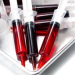 A tray with several syringes filled with red liquid and medical instruments, including scissors, on a white surface.